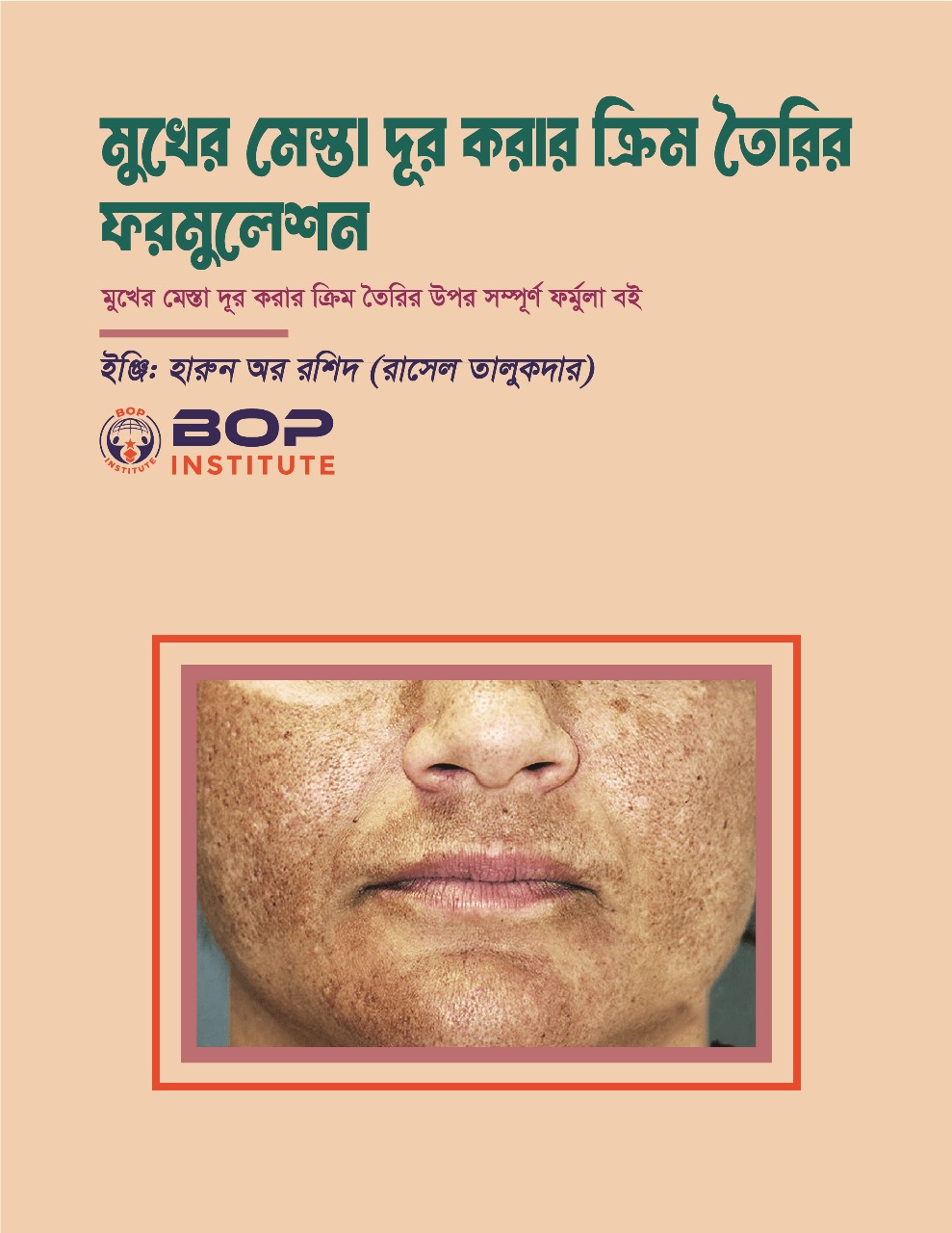 বাণিজ্যিকভাবে মুখের মেস্তা (Acne) দূর করার ক্রিম তৈরি করার জন্য একটি কার্যকরী ফর্মুলা এবং প্রজেক্ট